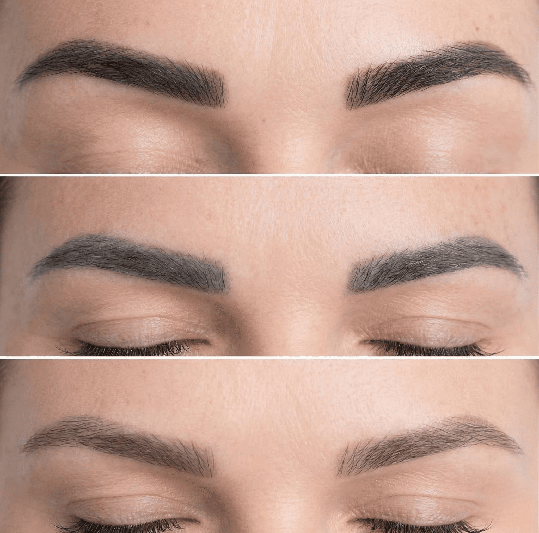 Remover-Behandlung PMU Entfernung Paderborn