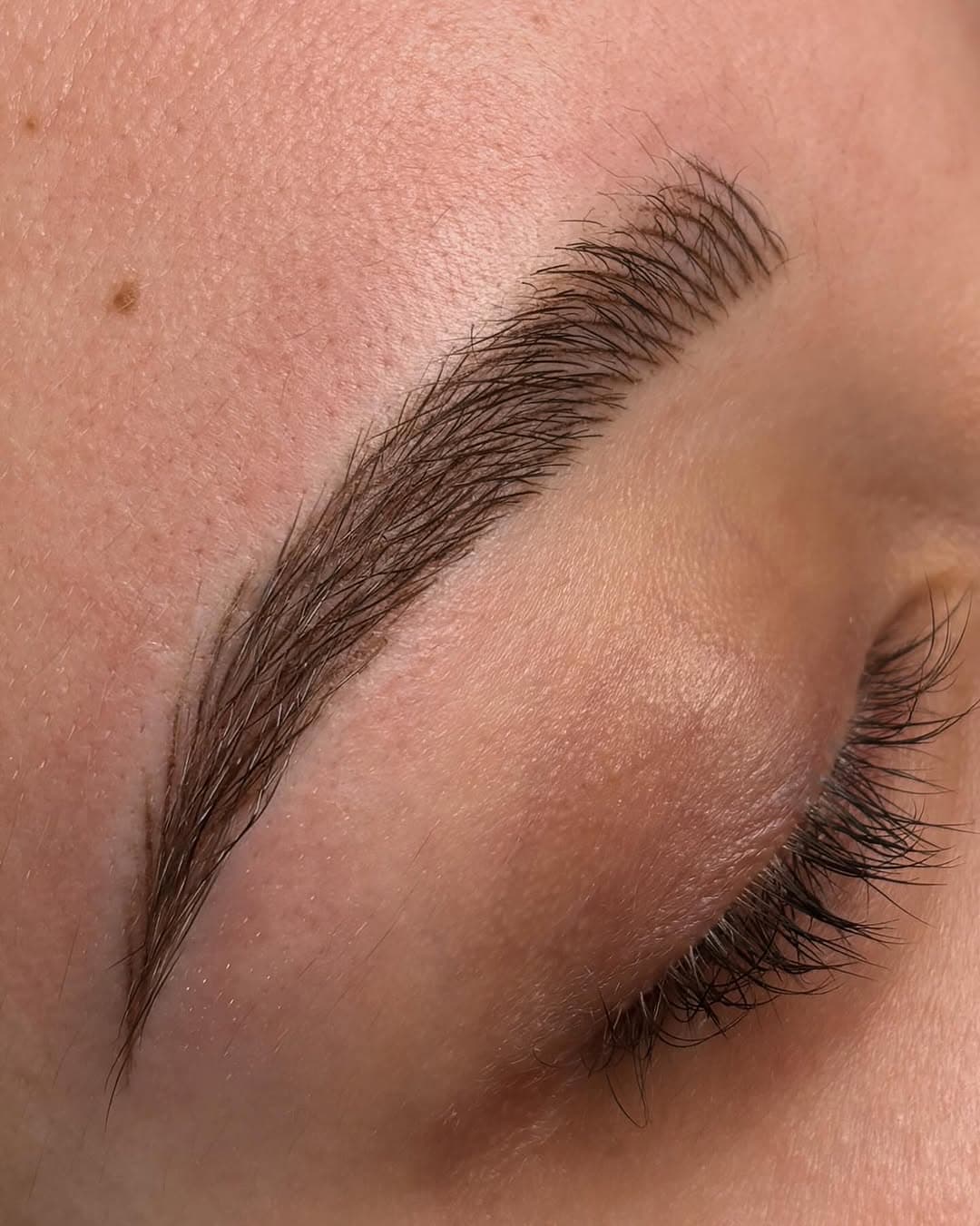 Browlifting Augenbrauenlifting Paderborn